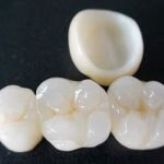 coronas-zirconia-dr-israel Dr. Israel zirconia
