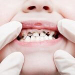 endodoncia-dr-israel Dr. Israel endodoncia1