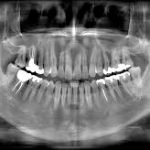 radiografia-dr-israel Dr, Israel radiografias1